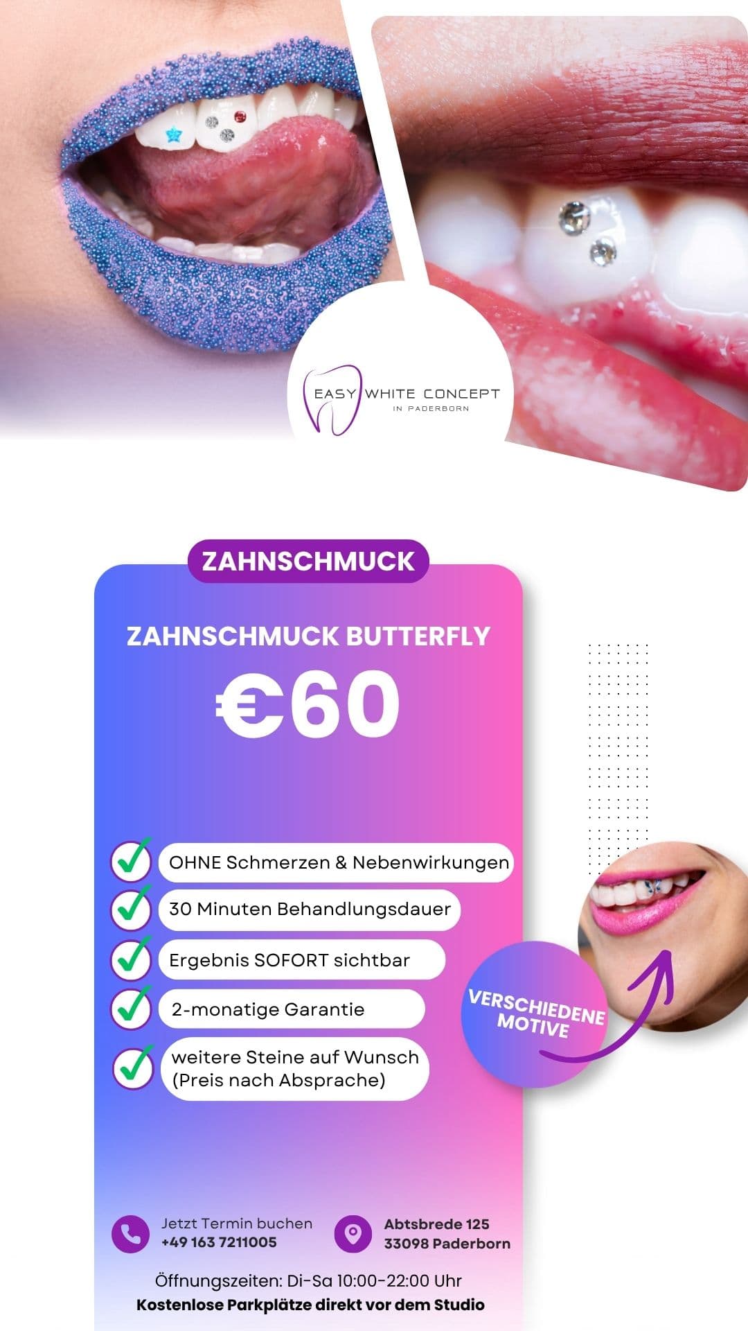 Zahnschmuck Detail